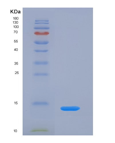 SDS-PAGE analysis of Human PPBP (Platelet Basic Protein) - Recombinant Protein, showing >85% purity under 15% SDS-PAGE (Reduced)