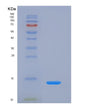 SDS-PAGE analysis of Human PPBP (Platelet Basic Protein) - Recombinant Protein, showing >85% purity under 15% SDS-PAGE (Reduced)