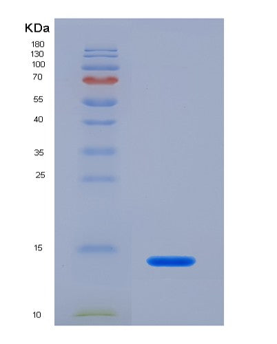 SDS-PAGE analysis of Human CXCL10 (C-X-C Motif Chemokine 10) - Recombinant Protein, showing >90% purity under 15% SDS-PAGE (Reduced)
