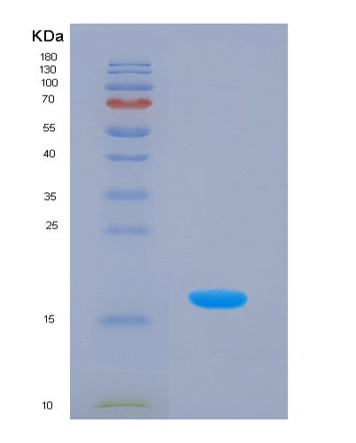 SDS-PAGE analysis of Human HPX (Hemopexin) - Recombinant Protein, showing >85% purity under 15% SDS-PAGE (Reduced)