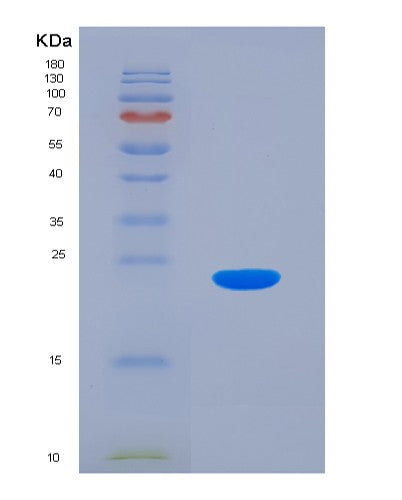 SDS-PAGE analysis of Human FTL (Ferritin Light Chain) - Recombinant Protein, showing >95% purity under 15% SDS-PAGE (Reduced)