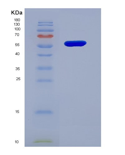 SDS-PAGE analysis of Human MMP1 (Interstitial Collagenase) - Recombinant Protein, showing >95% purity under 15% SDS-PAGE (Reduced)