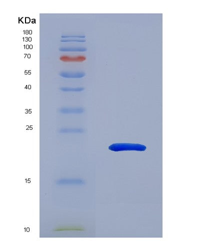 SDS-PAGE analysis of Human ATRN (Attractin) - Recombinant Protein, showing >90% purity under 15% SDS-PAGE (Reduced)