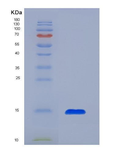 SDS-PAGE analysis of Human SLPI (Antileukoproteinase) - Recombinant Protein, showing >85% purity under 15% SDS-PAGE (Reduced)