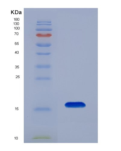 SDS-PAGE analysis of Human FABP4 (Fatty Acid-Binding Protein, Adipocyte) - Recombinant Protein, showing >90% purity under 15% SDS-PAGE (Reduced)