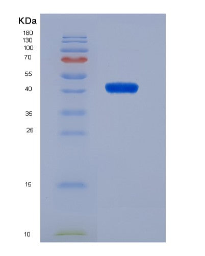 SDS-PAGE analysis of Human SLC10A1 (Hepatic Sodium/Bile Acid Cotransporter) - Recombinant Protein, showing >90% purity under 15% SDS-PAGE (Reduced)