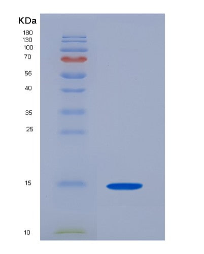 SDS-PAGE analysis of Human CSTB (Cystatin-B) - Recombinant Protein, showing >90% purity under 15% SDS-PAGE (Reduced)