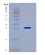 SDS-PAGE analysis of Human SOD2 (Superoxide Dismutase [Mn], Mitochondrial) - Recombinant Protein, showing >95% purity under 15% SDS-PAGE (Reduced)