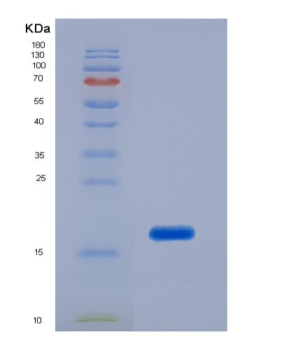 SDS-PAGE analysis of Human LCAT (Phosphatidylcholine-Sterol Acyltransferase) - Recombinant Protein, showing >85% purity under 15% SDS-PAGE (Reduced)