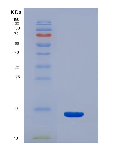SDS-PAGE analysis of Human S100B (Protein S100-B) - Recombinant Protein, showing >85% purity under 15% SDS-PAGE (Reduced)