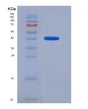 SDS-PAGE analysis of Human OGDH (2-Oxoglutarate Dehydrogenase Complex Component E1) - Recombinant Protein, showing >90% purity under 15% SDS-PAGE (Reduced)