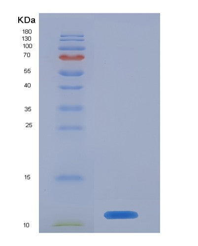 SDS-PAGE analysis of Human S100A8 (Protein S100-A8) - Recombinant Protein, showing >95% purity under 15% SDS-PAGE (Reduced)
