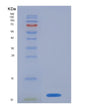 SDS-PAGE analysis of Human S100A8 (Protein S100-A8) - Recombinant Protein, showing >95% purity under 15% SDS-PAGE (Reduced)