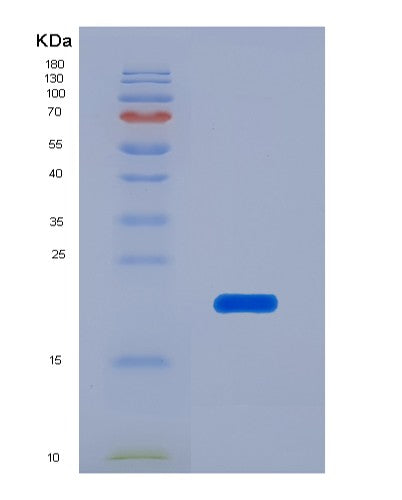 SDS-PAGE analysis of Human HMGN1 (Non-Histone Chromosomal Protein Hmg-14) - Recombinant Protein, showing >95% purity under 15% SDS-PAGE (Reduced)