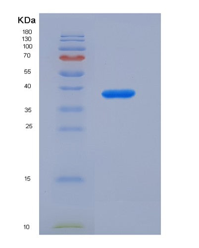 SDS-PAGE analysis of Human ALPL (Alkaline Phosphatase, Tissue-Nonspecific Isozyme) - Recombinant Protein, showing >90% purity under 15% SDS-PAGE (Reduced)