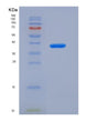 SDS-PAGE analysis of Human ALPL (Alkaline Phosphatase, Tissue-Nonspecific Isozyme) - Recombinant Protein, showing >90% purity under 15% SDS-PAGE (Reduced)