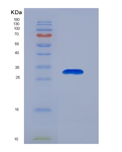 SDS-PAGE analysis of Human EIF2S1 (Eukaryotic Translation Initiation Factor 2 Subunit 1) - Recombinant Protein, showing >90% purity under 15% SDS-PAGE (Reduced)