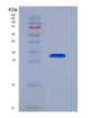 SDS-PAGE analysis of Human EIF2S1 (Eukaryotic Translation Initiation Factor 2 Subunit 1) - Recombinant Protein, showing >90% purity under 15% SDS-PAGE (Reduced)