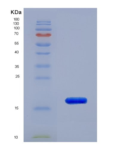 SDS-PAGE analysis of Human RPLP2 (Large Ribosomal Subunit Protein P2) - Recombinant Protein, showing >90% purity under 15% SDS-PAGE (Reduced)