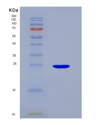 SDS-PAGE analysis of Human SCG5 (Neuroendocrine Protein 7B2) - Recombinant Protein, showing >85% purity under 15% SDS-PAGE (Reduced)