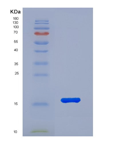 SDS-PAGE analysis of Human FABP3 (Fatty Acid-Binding Protein, Heart) - Recombinant Protein, showing >90% purity under 15% SDS-PAGE (Reduced)