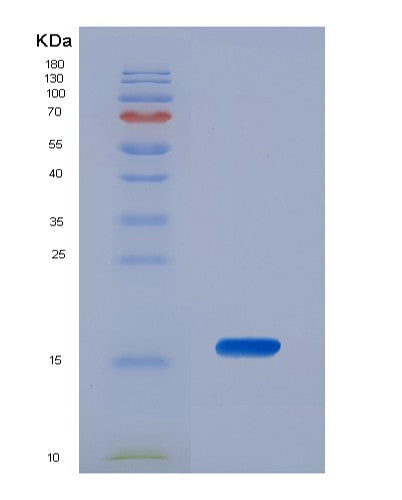 SDS-PAGE analysis of Human S100A6 (Protein S100-A6) - Recombinant Protein, showing >90% purity under 15% SDS-PAGE (Reduced)