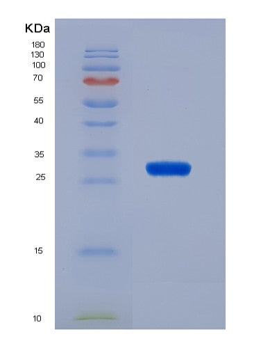 SDS-PAGE analysis of Human HEXA (Beta-Hexosaminidase Subunit Alpha) - Recombinant Protein, showing >85% purity under 15% SDS-PAGE (Reduced)