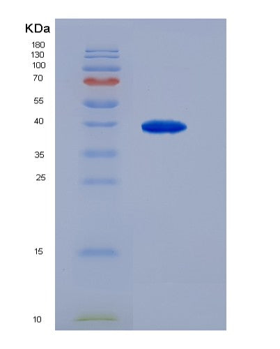 SDS-PAGE analysis of Human AGTR1 (Type-1 Angiotensin Ii Receptor) - Recombinant Protein, showing >90% purity under 15% SDS-PAGE (Reduced)