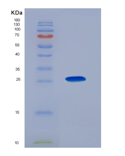 SDS-PAGE analysis of Human GP2 (Pancreatic Secretory Granule Membrane Major Glycoprotein Gp2) - Recombinant Protein, showing >90% purity under 15% SDS-PAGE (Reduced)