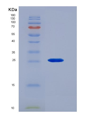 SDS-PAGE analysis of Human CTSB (Cathepsin B) - Recombinant Protein, showing >90% purity under 15% SDS-PAGE (Reduced)