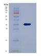 SDS-PAGE analysis of Human RCN2 (Reticulocalbin-2) - Recombinant Protein, showing >90% purity under 15% SDS-PAGE (Reduced)