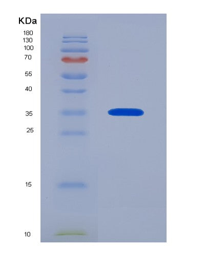 SDS-PAGE analysis of Human ASGR2 (Asialoglycoprotein Receptor 2) - Recombinant Protein, showing >85% purity under 15% SDS-PAGE (Reduced)