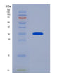 SDS-PAGE analysis of Human ASGR2 (Asialoglycoprotein Receptor 2) - Recombinant Protein, showing >85% purity under 15% SDS-PAGE (Reduced)