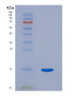 SDS-PAGE analysis of Human ACYP1 (Acylphosphatase-1) - Recombinant Protein, showing >95% purity under 15% SDS-PAGE (Reduced)