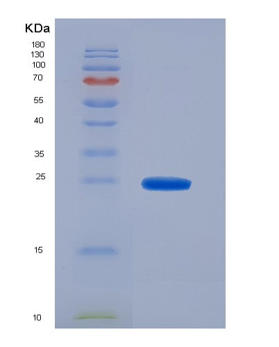 SDS-PAGE analysis of Human ADH1A (Alcohol Dehydrogenase 1A) - Recombinant Protein, showing >95% purity under 15% SDS-PAGE (Reduced)