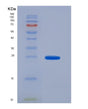 SDS-PAGE analysis of Human ADH1A (Alcohol Dehydrogenase 1A) - Recombinant Protein, showing >95% purity under 15% SDS-PAGE (Reduced)
