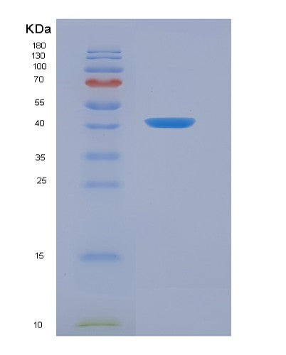SDS-PAGE analysis of Human ANXA2 (Annexin A2) - Recombinant Protein, showing >95% purity under 15% SDS-PAGE (Reduced)