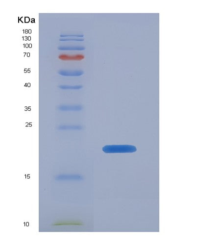 SDS-PAGE analysis of Human CTSL (Procathepsin L) - Recombinant Protein, showing >90% purity under 15% SDS-PAGE (Reduced)