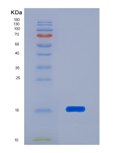 SDS-PAGE analysis of Human PFN1 (Profilin-1) - Recombinant Protein, showing >95% purity under 15% SDS-PAGE (Reduced)