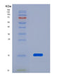 SDS-PAGE analysis of Human PFN1 (Profilin-1) - Recombinant Protein, showing >95% purity under 15% SDS-PAGE (Reduced)