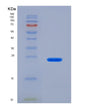 SDS-PAGE analysis of Human APRT (Adenine Phosphoribosyltransferase) - Recombinant Protein, showing >90% purity under 15% SDS-PAGE (Reduced)