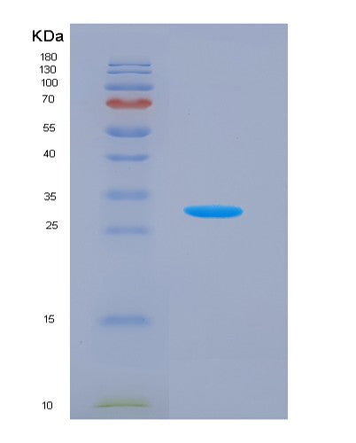 SDS-PAGE analysis of Human LYN (Tyrosine-Protein Kinase Lyn) - Recombinant Protein, showing >90% purity under 15% SDS-PAGE (Reduced)