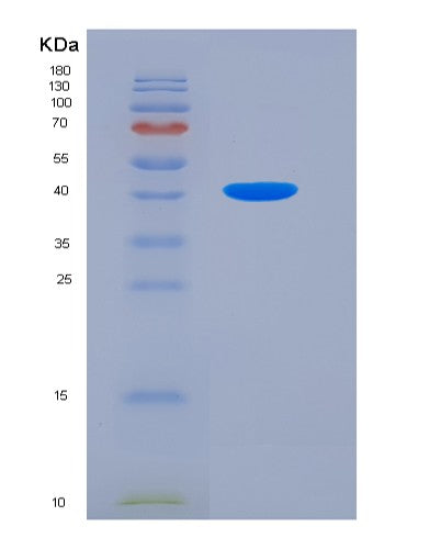 SDS-PAGE analysis of Human TPM2 (Tropomyosin Beta Chain) - Recombinant Protein, showing >90% purity under 15% SDS-PAGE (Reduced)