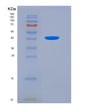 SDS-PAGE analysis of Human TPM2 (Tropomyosin Beta Chain) - Recombinant Protein, showing >90% purity under 15% SDS-PAGE (Reduced)