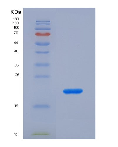 SDS-PAGE analysis of Human FH (Fumarate Hydratase, Mitochondrial) - Recombinant Protein, showing >85% purity under 15% SDS-PAGE (Reduced)
