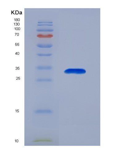 SDS-PAGE analysis of Human ANXA6 (Annexin A6) - Recombinant Protein, showing >90% purity under 15% SDS-PAGE (Reduced)