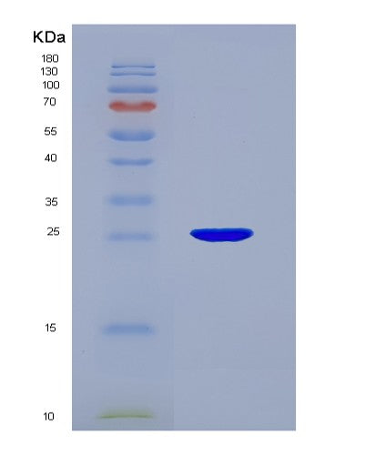 SDS-PAGE analysis of Human GSTA1 (Glutathione S-Transferase A1) - Recombinant Protein, showing >95% purity under 15% SDS-PAGE (Reduced)