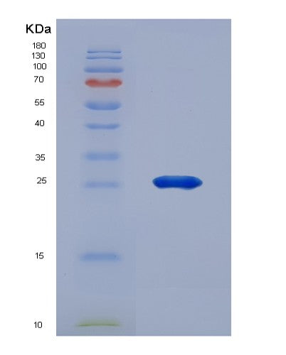 SDS-PAGE analysis of Human MMP2 (72 Kda Type Iv Collagenase) - Recombinant Protein, showing >95% purity under 15% SDS-PAGE (Reduced)