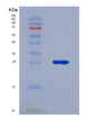 SDS-PAGE analysis of Human MMP2 (72 Kda Type Iv Collagenase) - Recombinant Protein, showing >95% purity under 15% SDS-PAGE (Reduced)