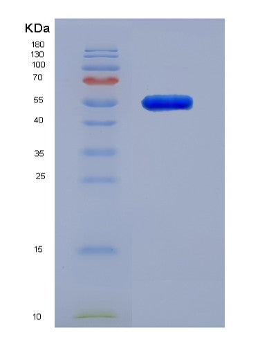 SDS-PAGE analysis of Human MMP3 (Stromelysin-1) - Recombinant Protein, showing >95% purity under 15% SDS-PAGE (Reduced)
